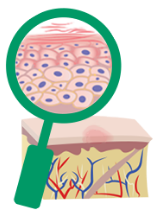 A close up look of skin cells in patients treated with Dupixent® (dupilumab) for Uncontrolled Moderate-to-Severe Eczema (Atopic Dermatitis)